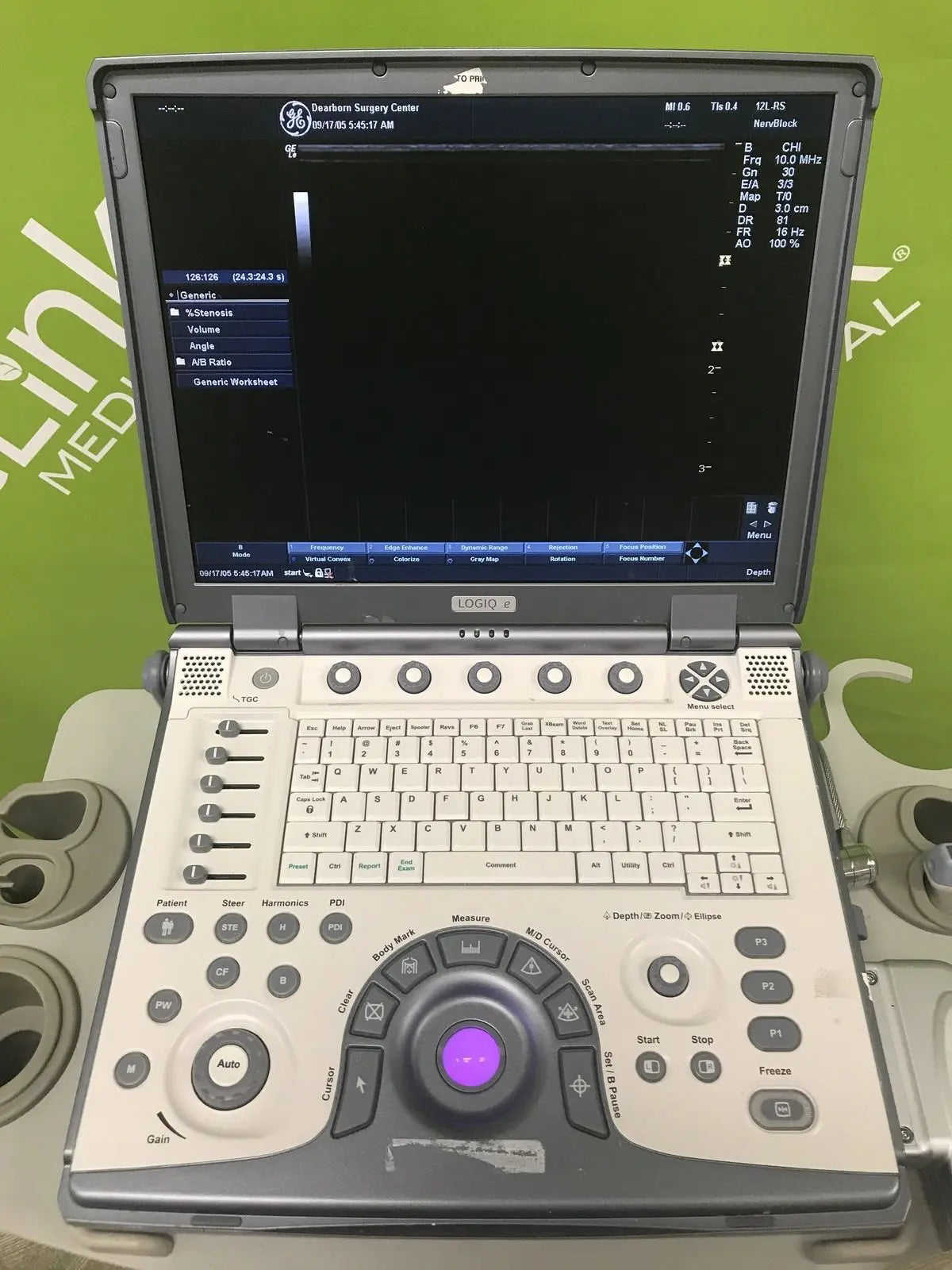 GE Logiq e Portable Ultrasound System Medical DIAGNOSTIC ULTRASOUND MACHINES FOR SALE