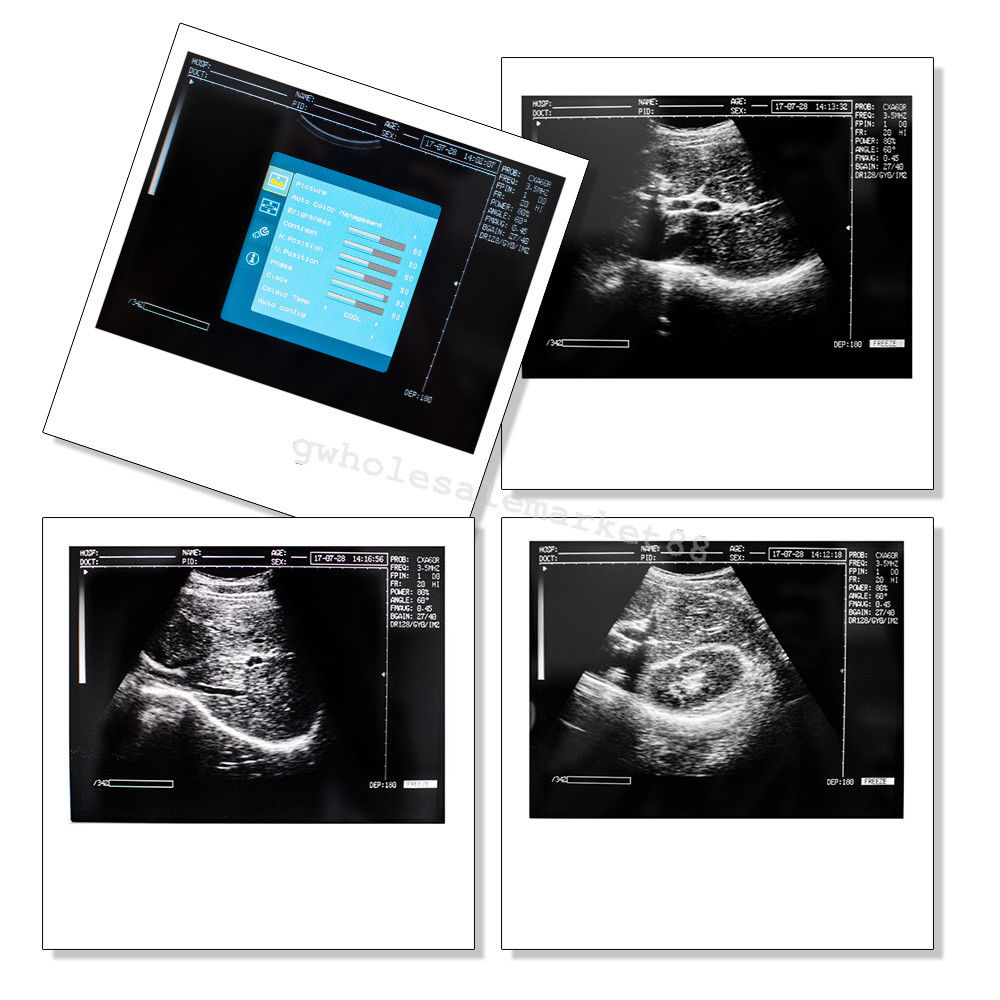 Laptop Ultrasound Machine Scanner Convex Probe 3D Software High Resolution Clear 190891045898 DIAGNOSTIC ULTRASOUND MACHINES FOR SALE