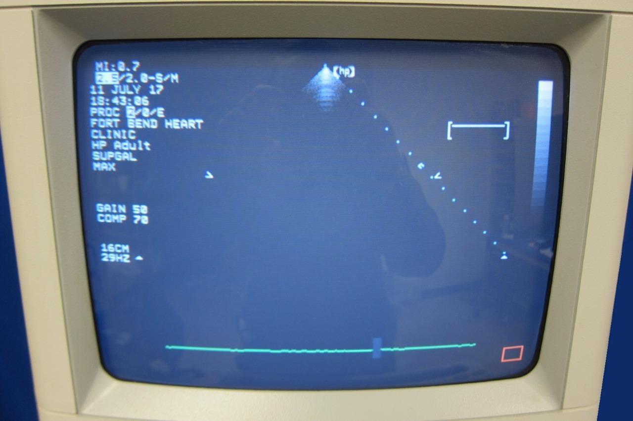 an old computer monitor with a blue screen