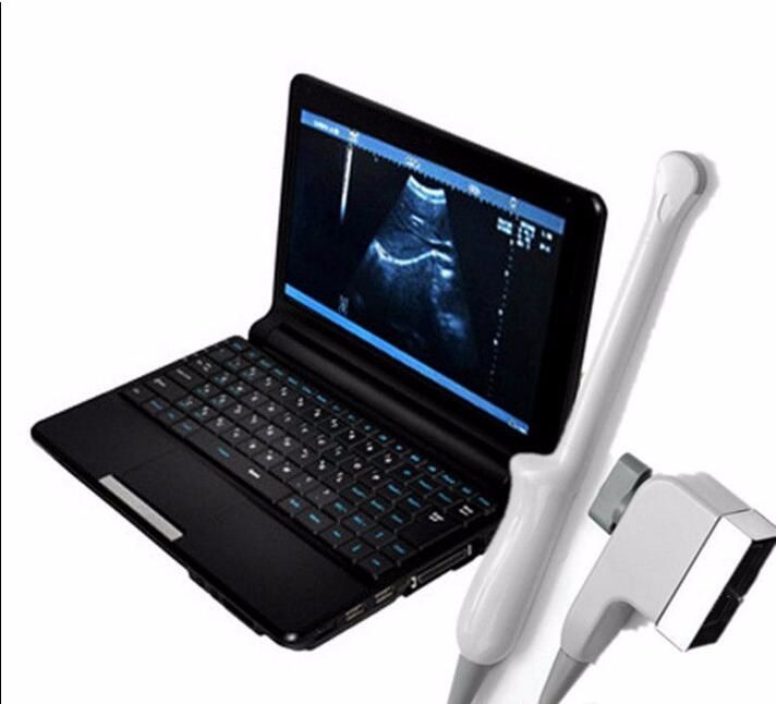 Laptop Ultrasound scanner Machine +Transvaginal probe Free D + Carry Box Fast 190891350886 DIAGNOSTIC ULTRASOUND MACHINES FOR SALE