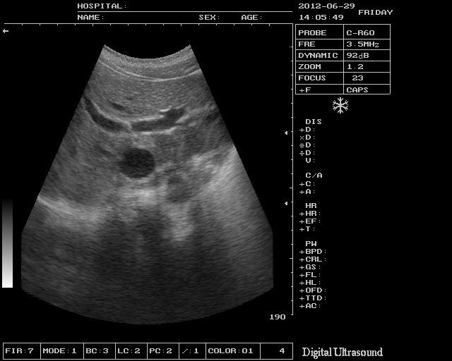 Medical Ultrasonic Machine Ultrasound Scanner Linear Probe/Sensor 3D Software AA 190891665829 DIAGNOSTIC ULTRASOUND MACHINES FOR SALE