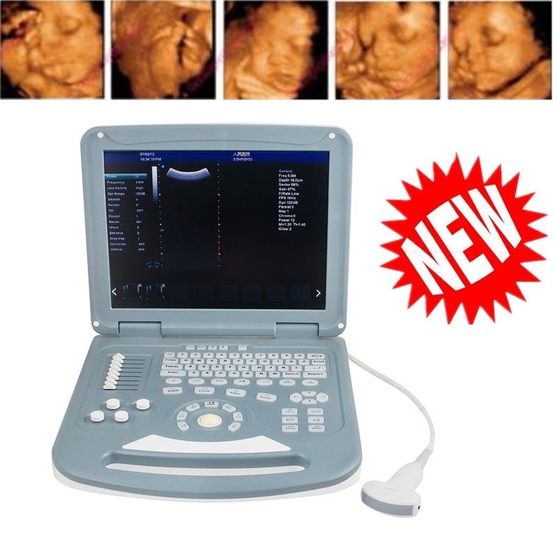 15" Digital Color Doppler Ultrasound Scanner Diagnostic Convex Linear Probe A+ 190891276681 DIAGNOSTIC ULTRASOUND MACHINES FOR SALE