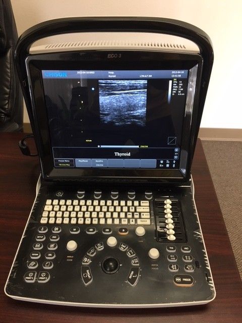 Chison ECO 3 Portable Ultrasound System DIAGNOSTIC ULTRASOUND MACHINES FOR SALE