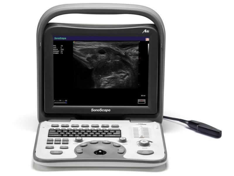 SonoScape A6V Veterinary Ultrasound Scanner Equipment, Probe Choice, Best Deal DIAGNOSTIC ULTRASOUND MACHINES FOR SALE