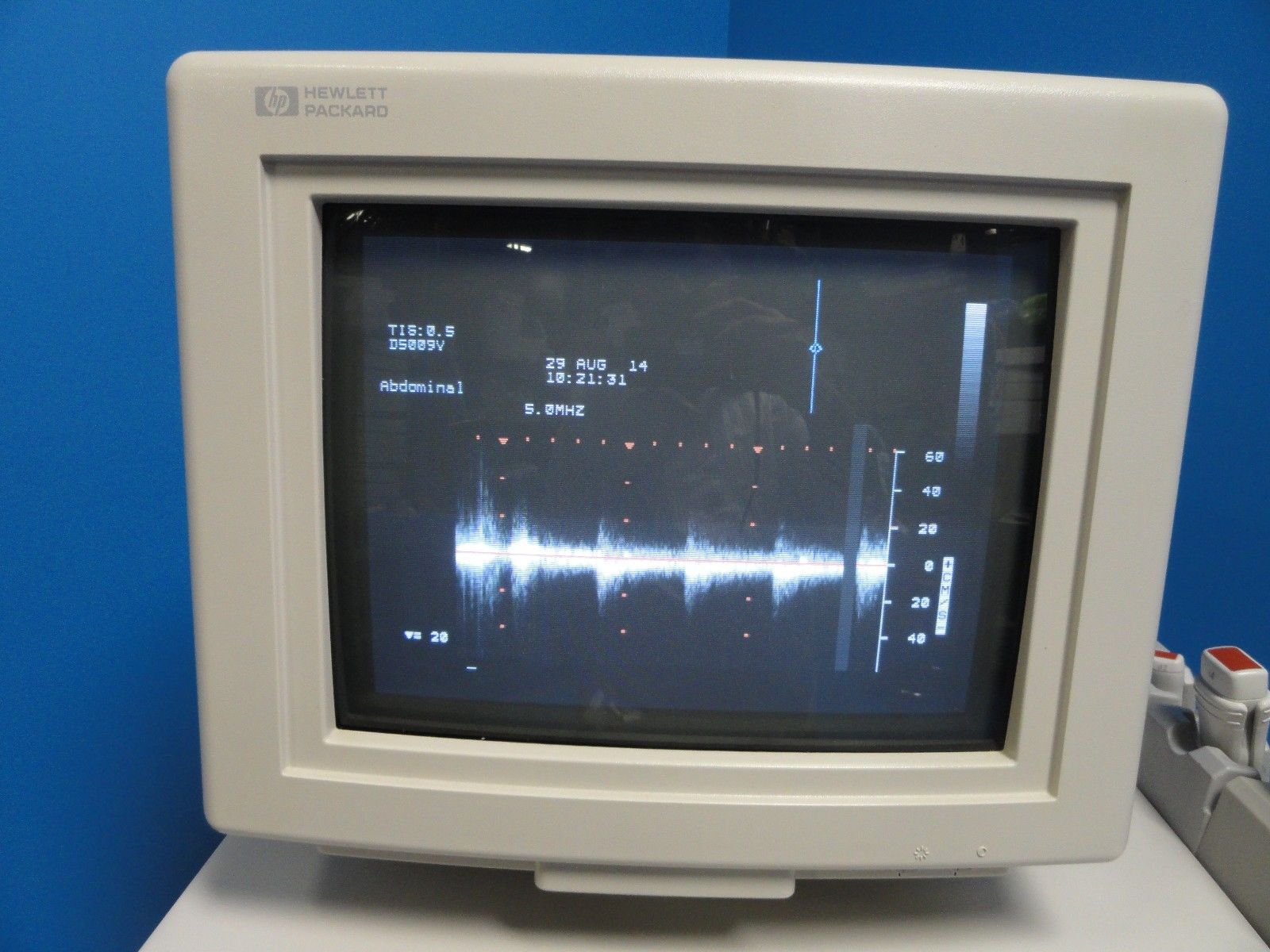an old computer monitor with sound waves on it