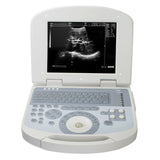 USA 10.4 inch Digital Laptop Medical Ultrasound Scanner 3.5MHZ Convex Probe USA