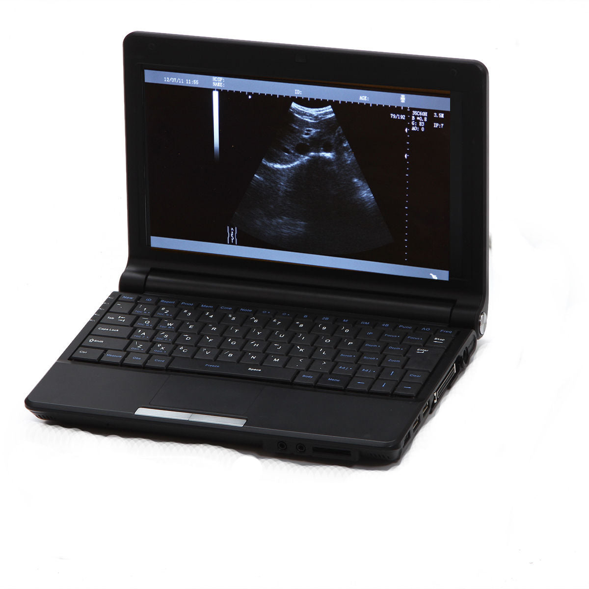 Digital Portable Ultrasound Machine Scanner System Convex Probe 3D + PR Oximeter DIAGNOSTIC ULTRASOUND MACHINES FOR SALE