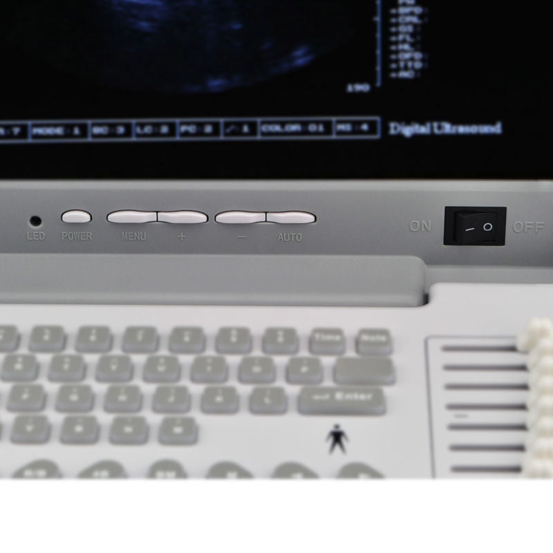 Full Digital Laptop Portable Ultrasound Scanner+Transvaginal Probe  external 3D DIAGNOSTIC ULTRASOUND MACHINES FOR SALE
