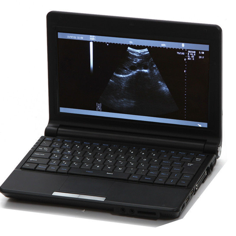 Fast Ship Portable Laptop Ultrasound Scanner+Linear Probe+Free 3D Workstation CE 190891830807 DIAGNOSTIC ULTRASOUND MACHINES FOR SALE