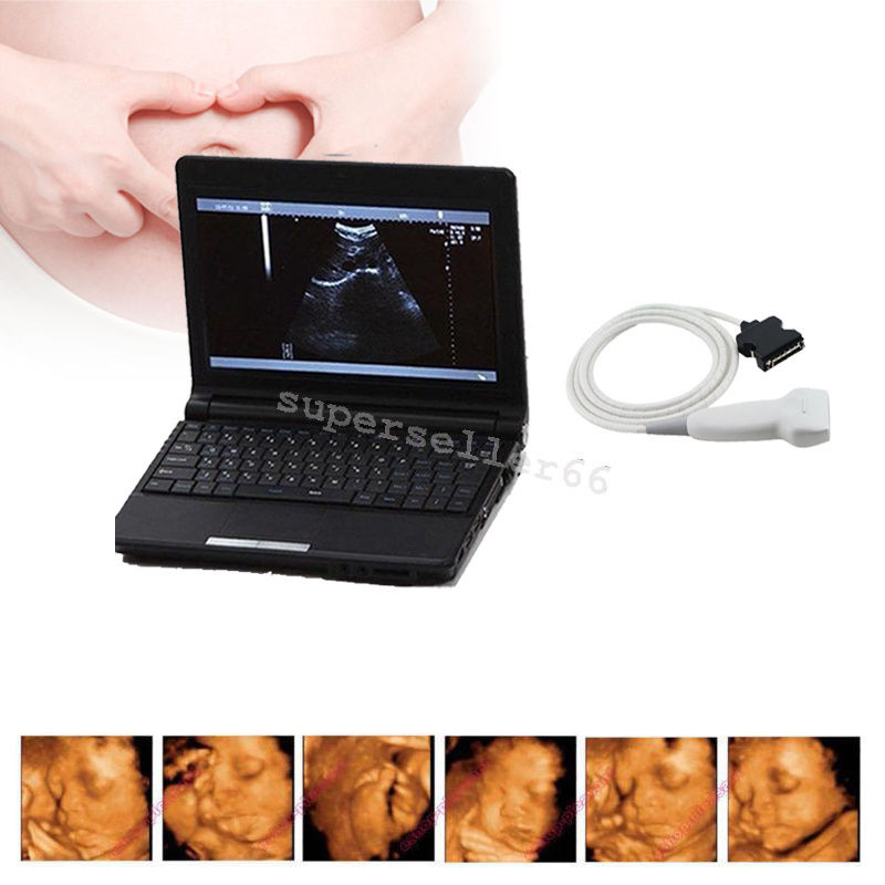 10.1'' LCD Preganancy Check Machine Ultrasound scanner with 7.5MHz Linear probe DIAGNOSTIC ULTRASOUND MACHINES FOR SALE