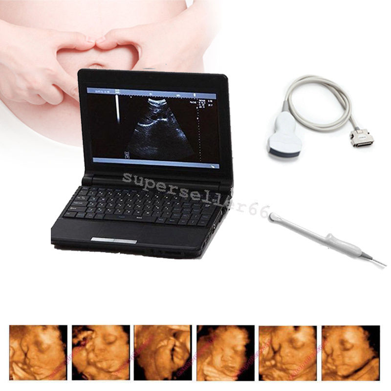 LCD Digital 10.1 Inch Ultrasound Scanner + Convex ,Transvaginal Probe ,Battery DIAGNOSTIC ULTRASOUND MACHINES FOR SALE