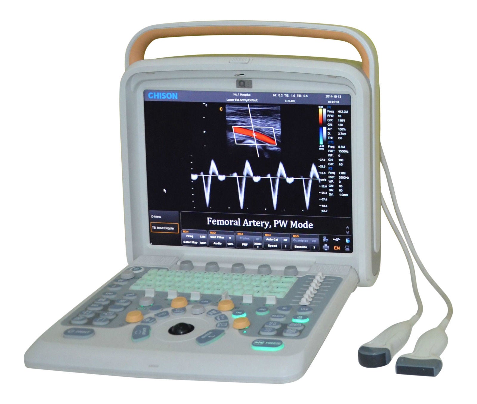 Color Doppler Ultrasound Scanner & Two probes Convex&Linear Probe - Chison Q5 DIAGNOSTIC ULTRASOUND MACHINES FOR SALE