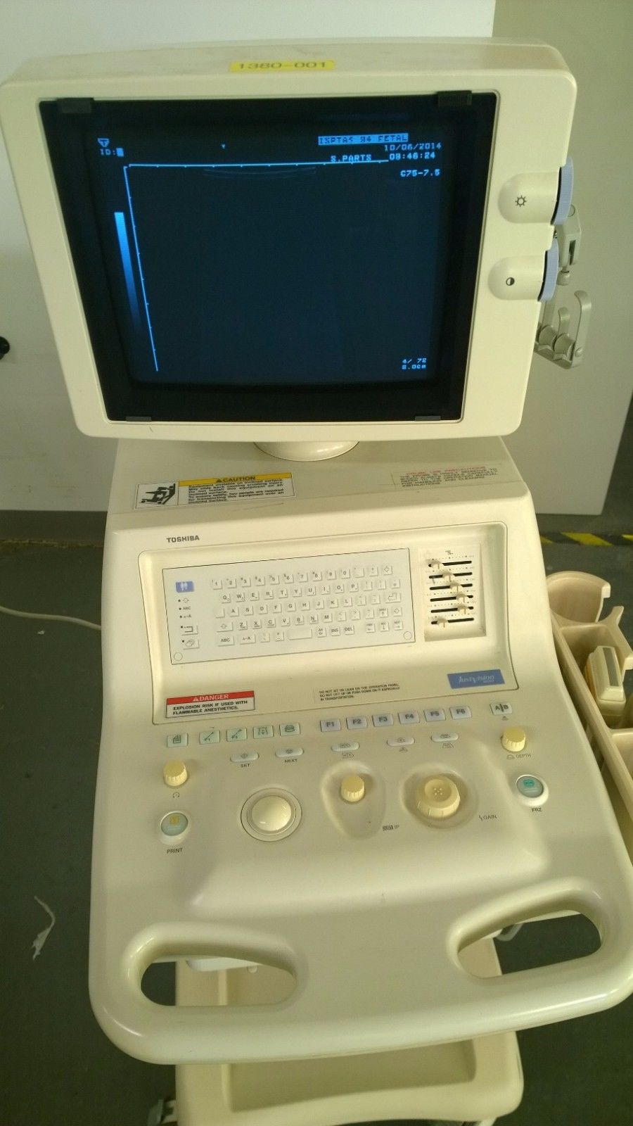 Toshiba SSA-325A Justvision 400 2001 Ultrasound DIAGNOSTIC ULTRASOUND MACHINES FOR SALE