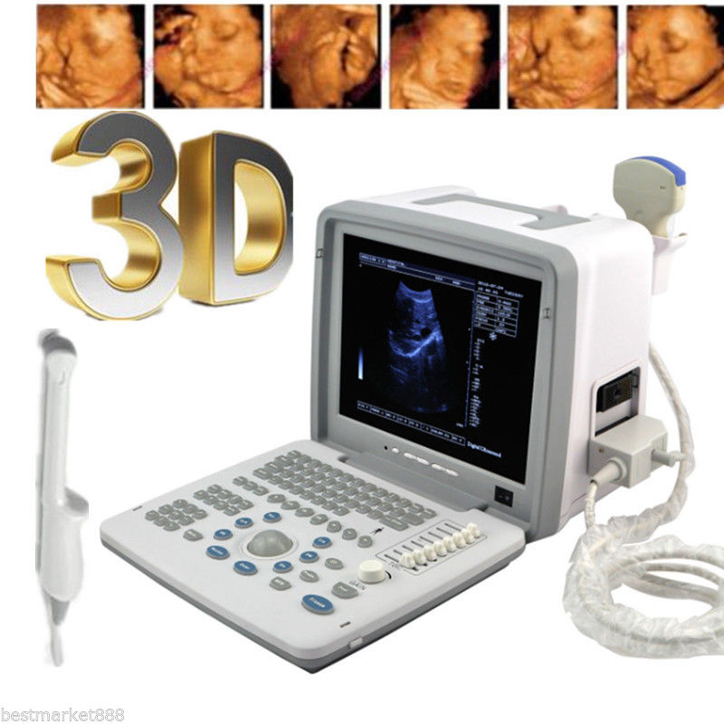 LCD 12'' Digital Ultrasound Scanner Machine Convex Transvaginal 2 Probes Free 3D DIAGNOSTIC ULTRASOUND MACHINES FOR SALE
