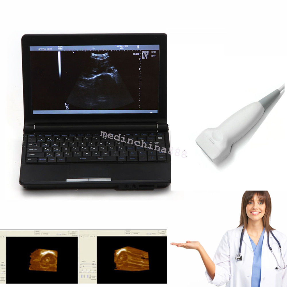 10.1''LCD Display Digital Ultrasound Scanner+ Linear Probe Clinc Human N Pet 190891246561 DIAGNOSTIC ULTRASOUND MACHINES FOR SALE