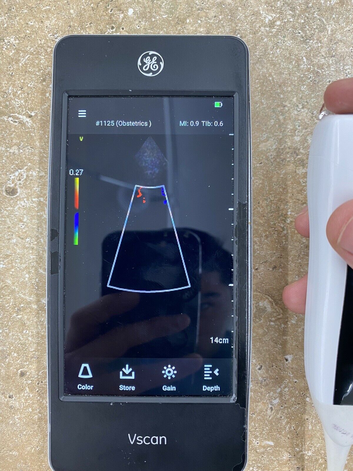 GE Vscan Extend with Single Probe Ultrasound System - DIAGNOSTIC