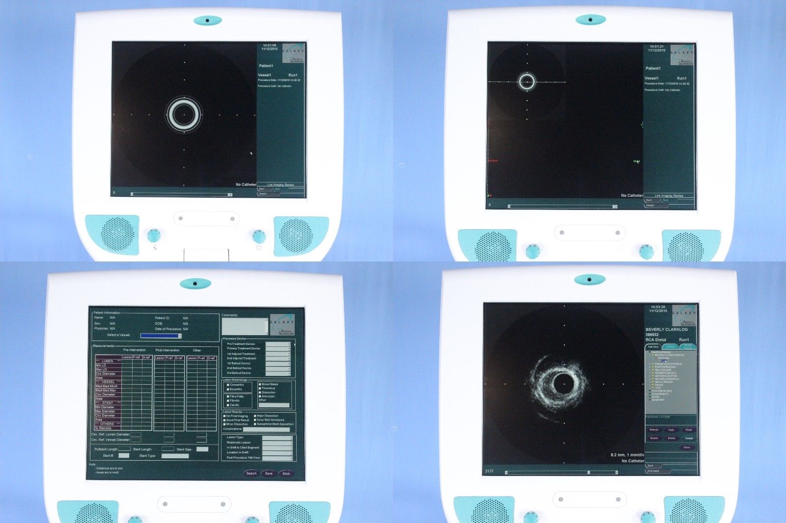 Boston Scientific Galaxy 2 IVUS Imaging System Cardiac Vascular Ultrasound DIAGNOSTIC ULTRASOUND MACHINES FOR SALE