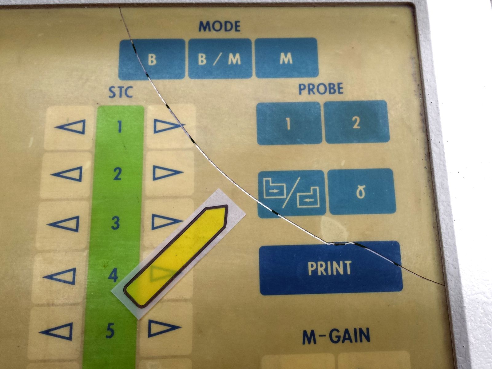 SHIMADZU SHIMASONIC SDL-310 OB/GYN ULTRASOUND DIAGNOSTIC IMAGING PATIENT MONTIOR DIAGNOSTIC ULTRASOUND MACHINES FOR SALE