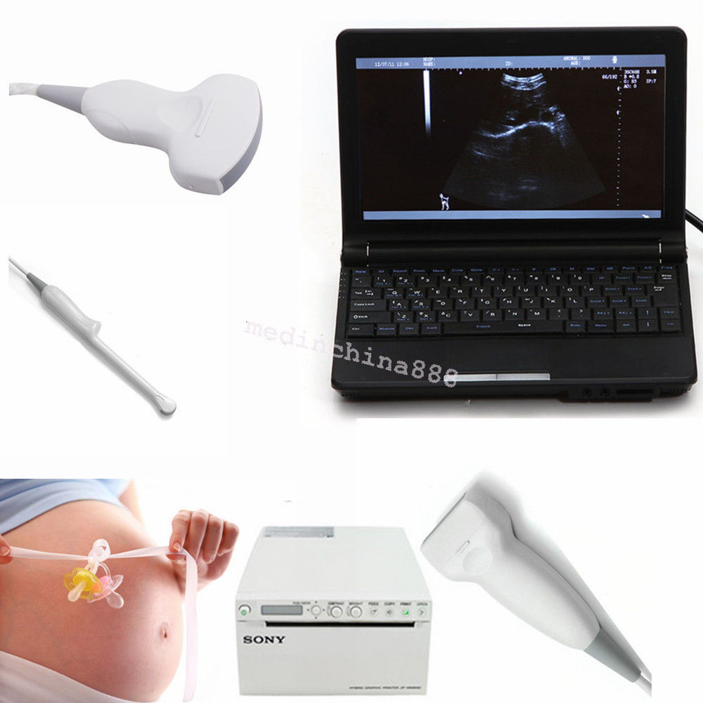 10" Laptop Ultrasound Scanner+Convex+Linear+Transvaginal,Probe+Thermal Printer DIAGNOSTIC ULTRASOUND MACHINES FOR SALE