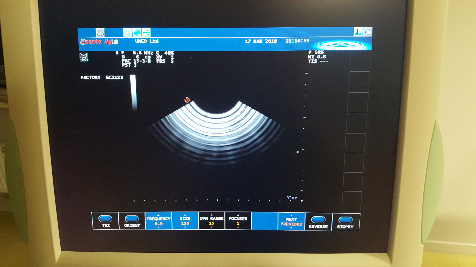 Biosound / Esaote MyLab 40 Diagnostic Ultrasound unit OB / GYN DIAGNOSTIC ULTRASOUND MACHINES FOR SALE