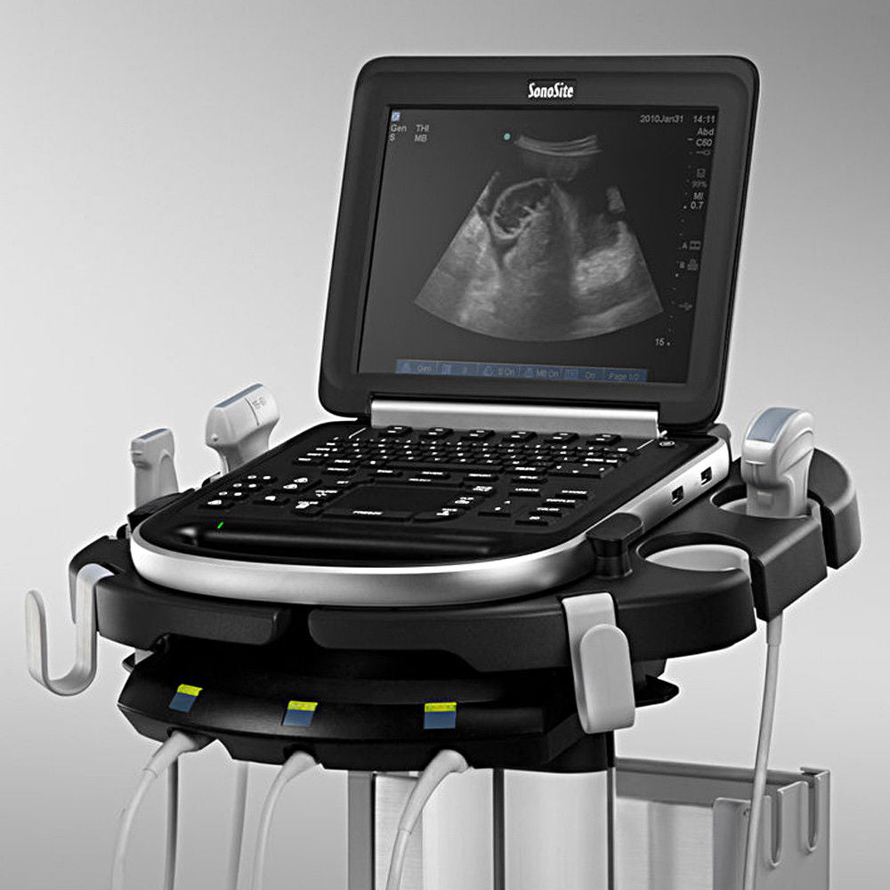 SonoSite Edge Ultrasound System Scanner Machine - Box Only - Package ON SALE DIAGNOSTIC ULTRASOUND MACHINES FOR SALE