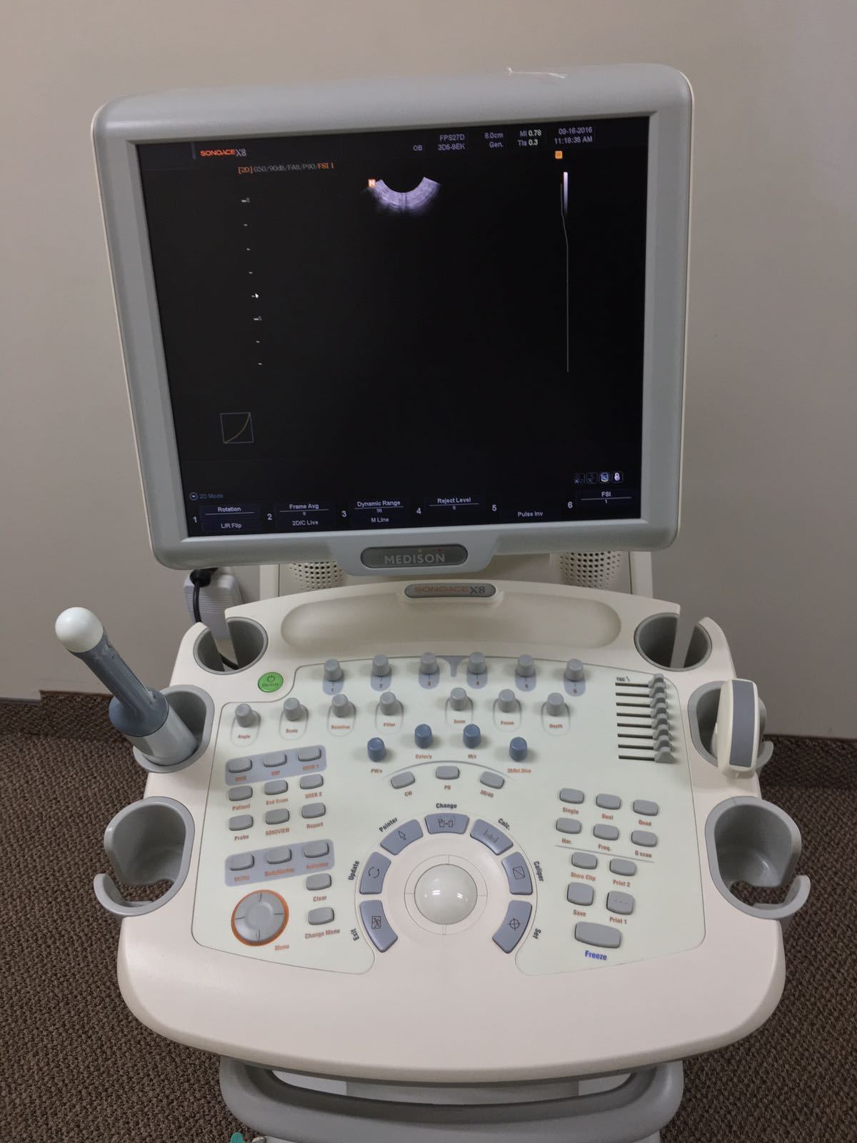 Medison SonoAce X8 OB/Gyn Ultrasound System w/ 3D5-9EK, 3D/4D, C2-8