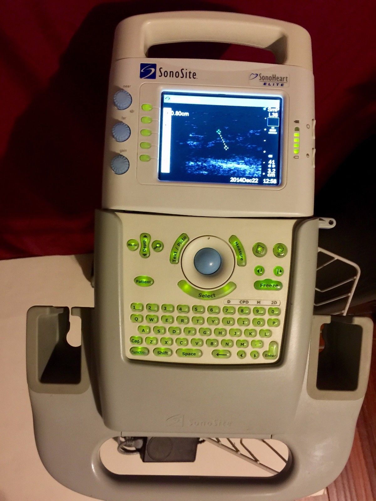 SONOSITE Ultrasound  Sonoheart Elite With Cart DIAGNOSTIC ULTRASOUND MACHINES FOR SALE