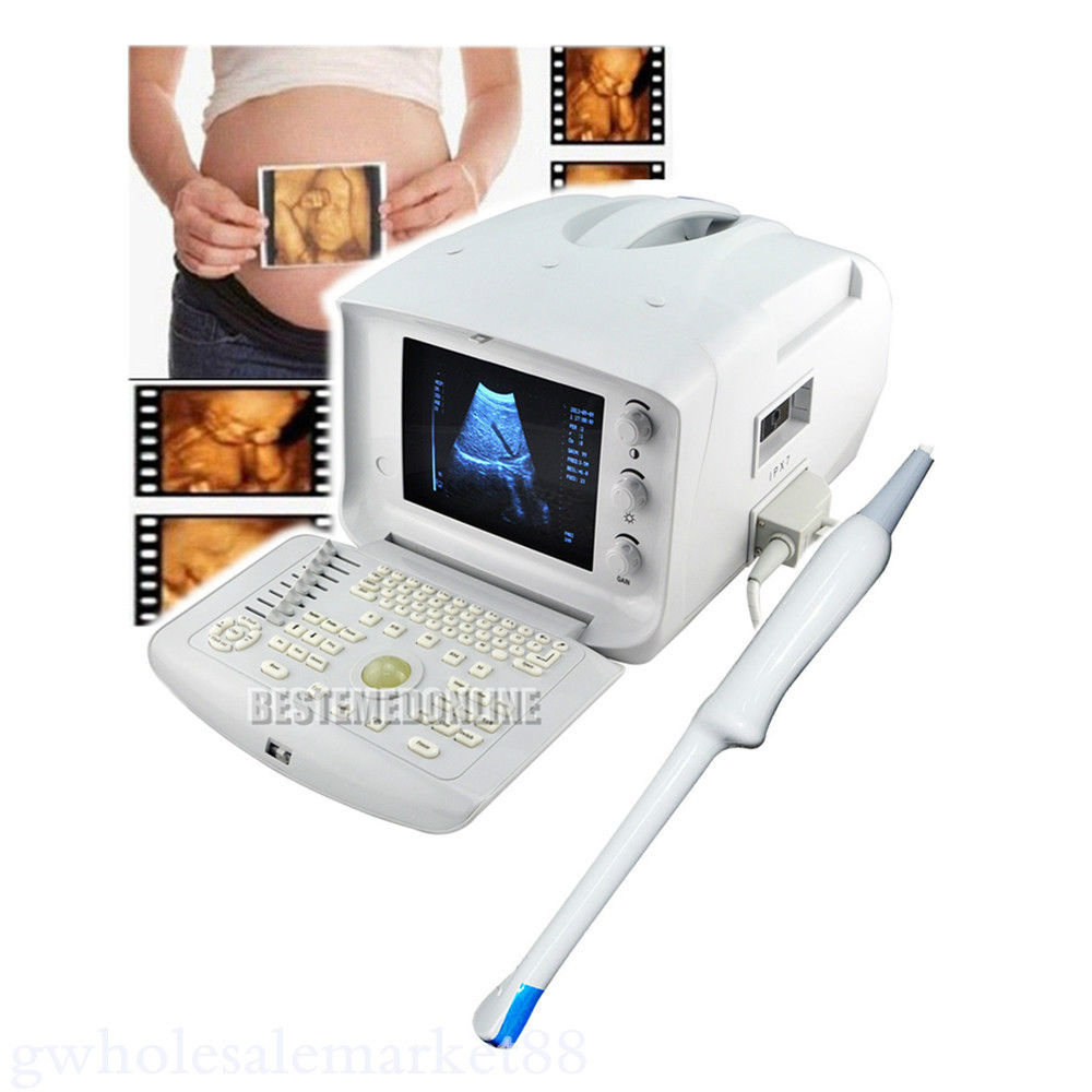 Transvaginal Machine Portable Ultrasound Scanner with 3D Software
