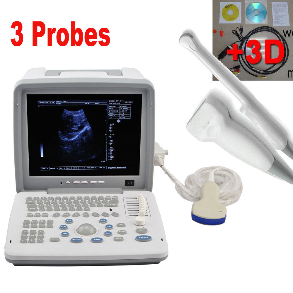 Transvaginal Machine Digital Ultrasound Scanner Machine Convex/Linear/Transvaginal 3 Probes