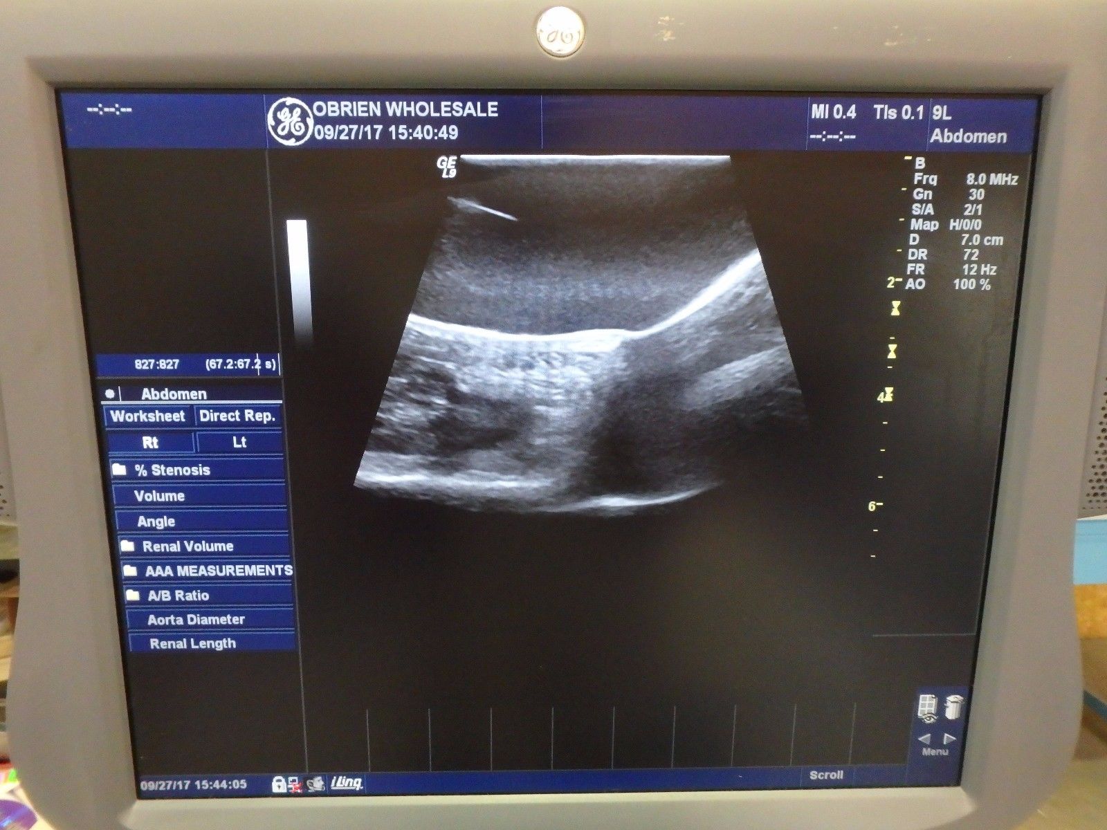 ultrasound monitor screeen