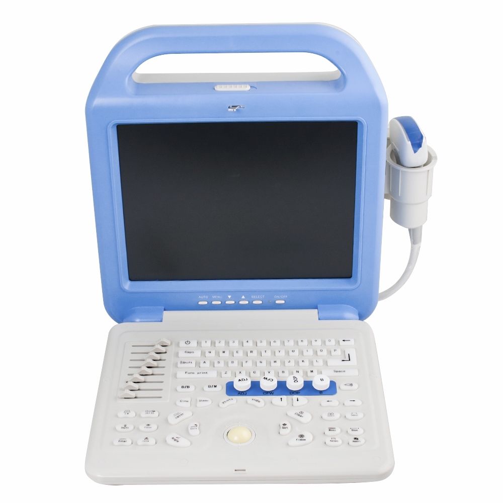 Laptop Color Doppler Ultrasonic Ultrasound Scanner Convex Linear 2 Probes  A+ DIAGNOSTIC ULTRASOUND MACHINES FOR SALE
