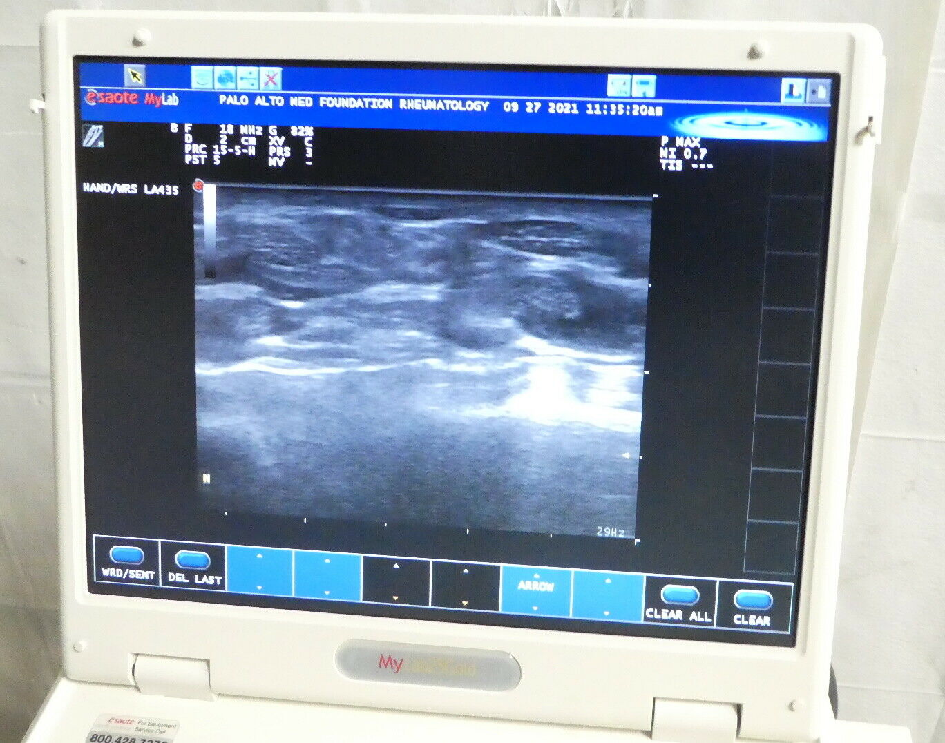 R178283 ESAOTE S.p.A. Biosound MyLab25Gold Ultrasound System - Two Probes DIAGNOSTIC ULTRASOUND MACHINES FOR SALE