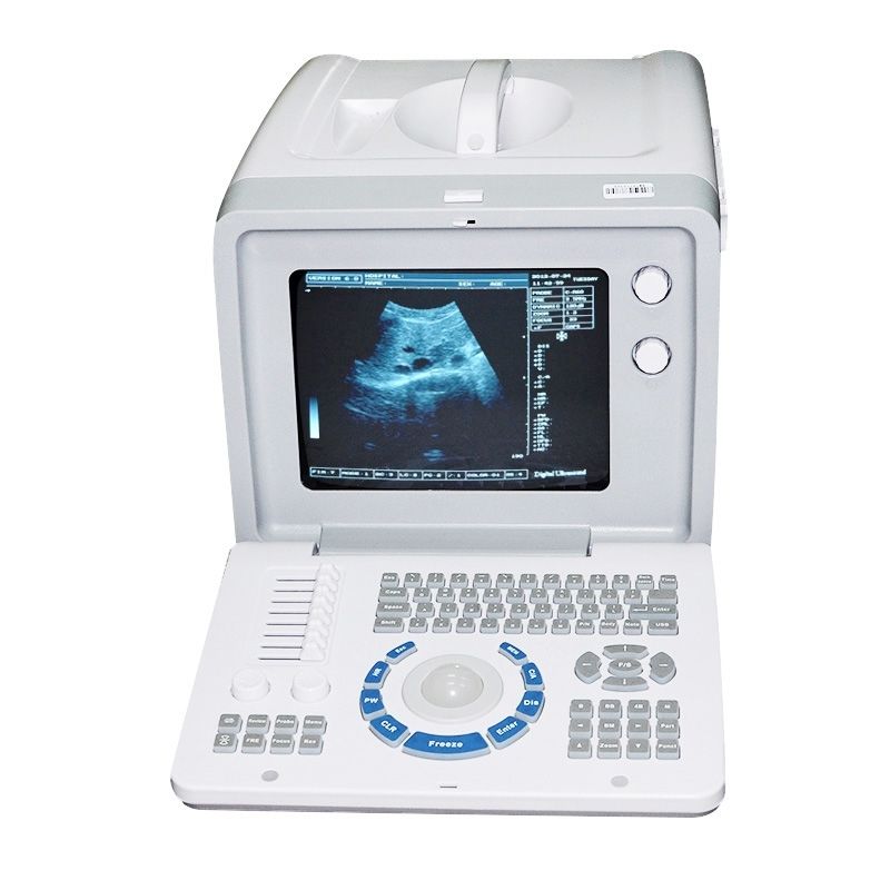 Profession 3D Full Digital Ultrasound Scanner Machine+Convex+Transvaginal 2Probe DIAGNOSTIC ULTRASOUND MACHINES FOR SALE