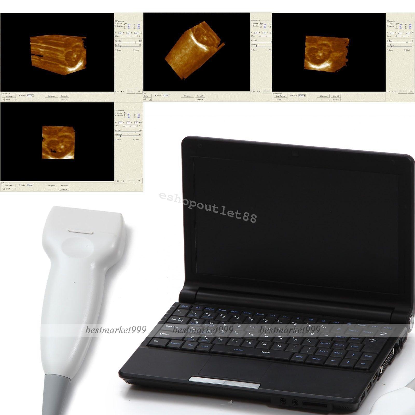 CE Full Digital Laptop Ultrasound Scanner with Linear probe +Free 3D