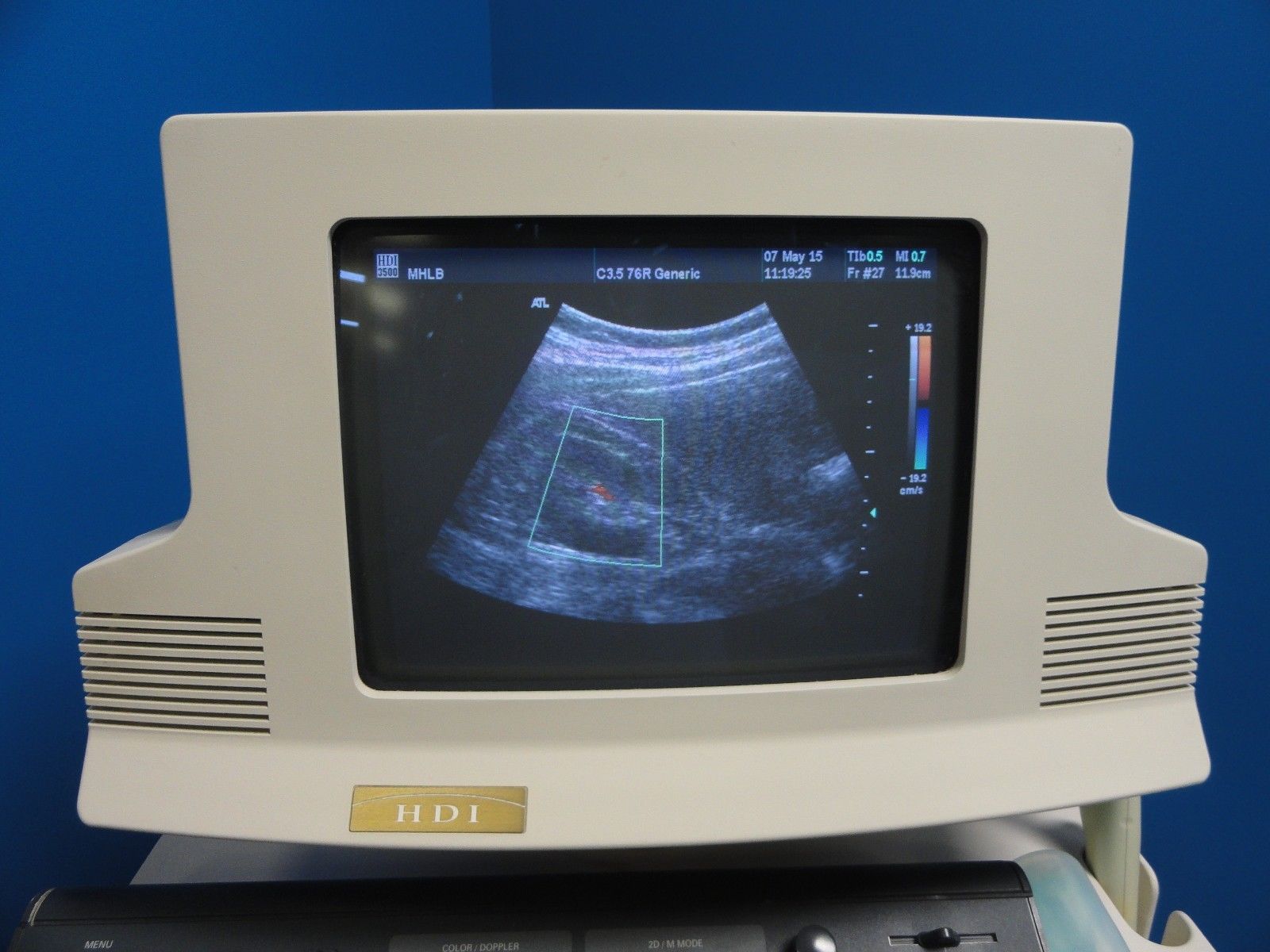 Philips ATL C3.5 76R  Convex / Curved Array Ultrasound Transducer Probe (8837) DIAGNOSTIC ULTRASOUND MACHINES FOR SALE