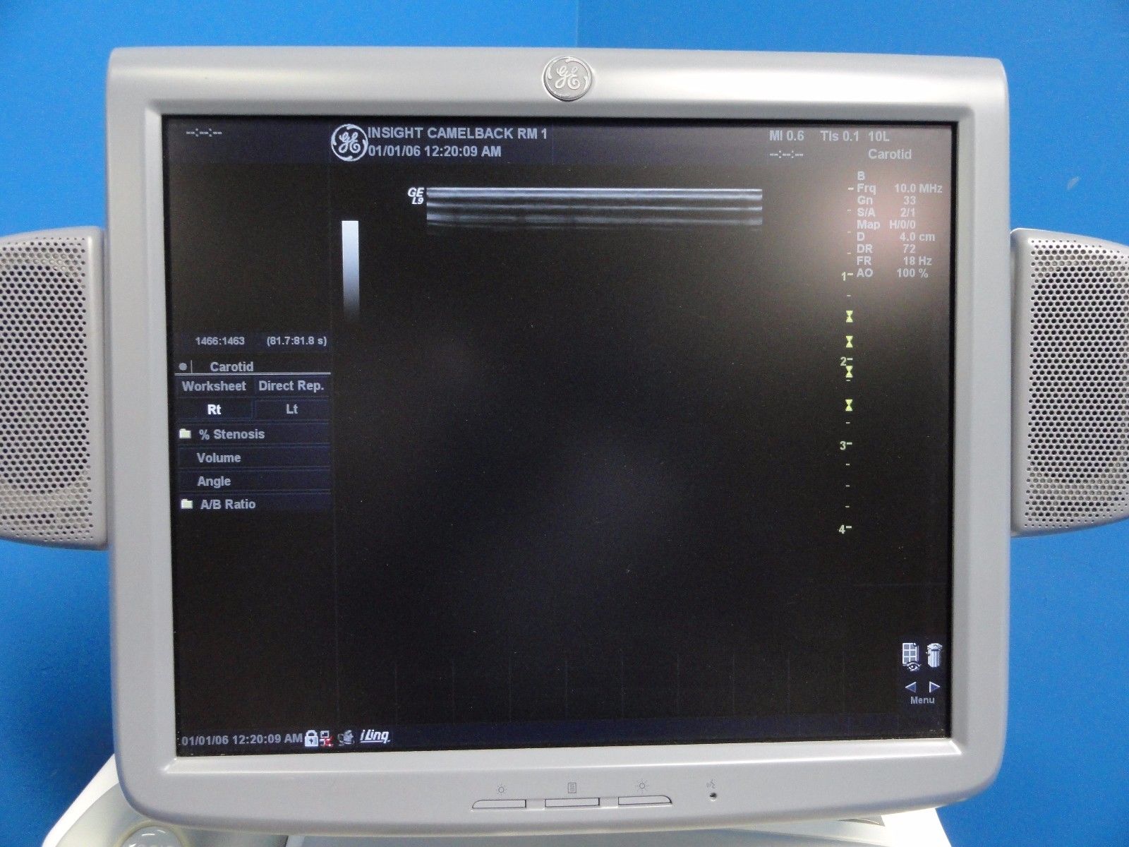 2010 GE 10L P/N 2302650 Linear Array Probe For GE Logiq & Vivid Series ~13712 DIAGNOSTIC ULTRASOUND MACHINES FOR SALE