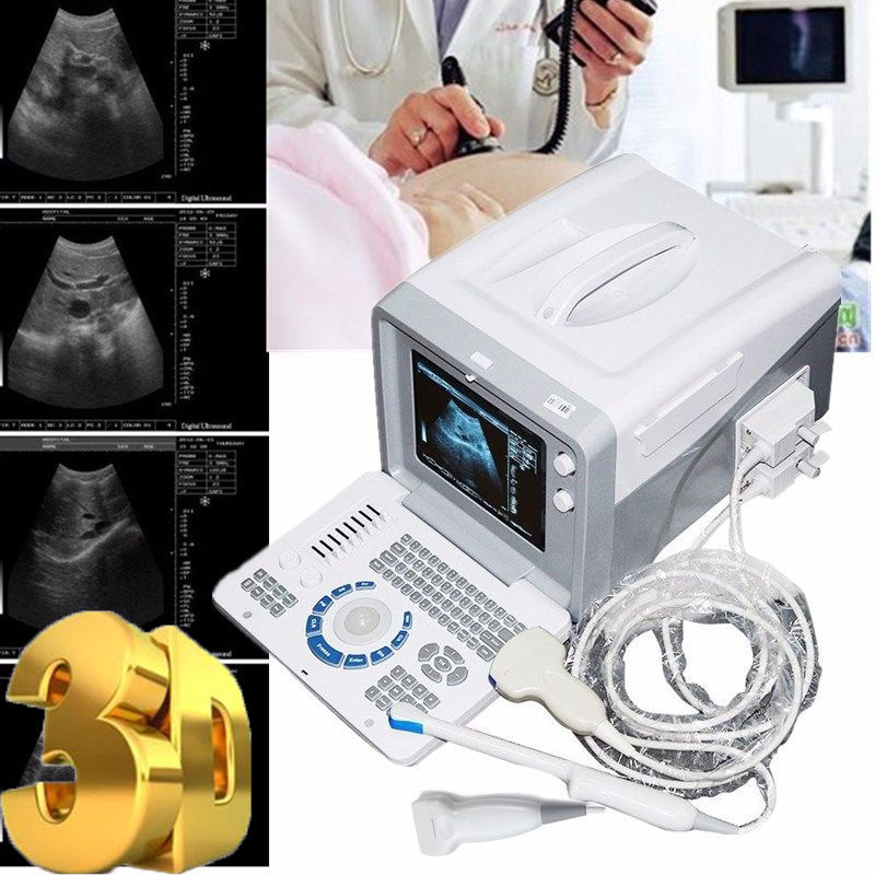 Transvaginal Machine Professional Digital Ultrasound Machine Covex/ Linear/ Transvaginal 3