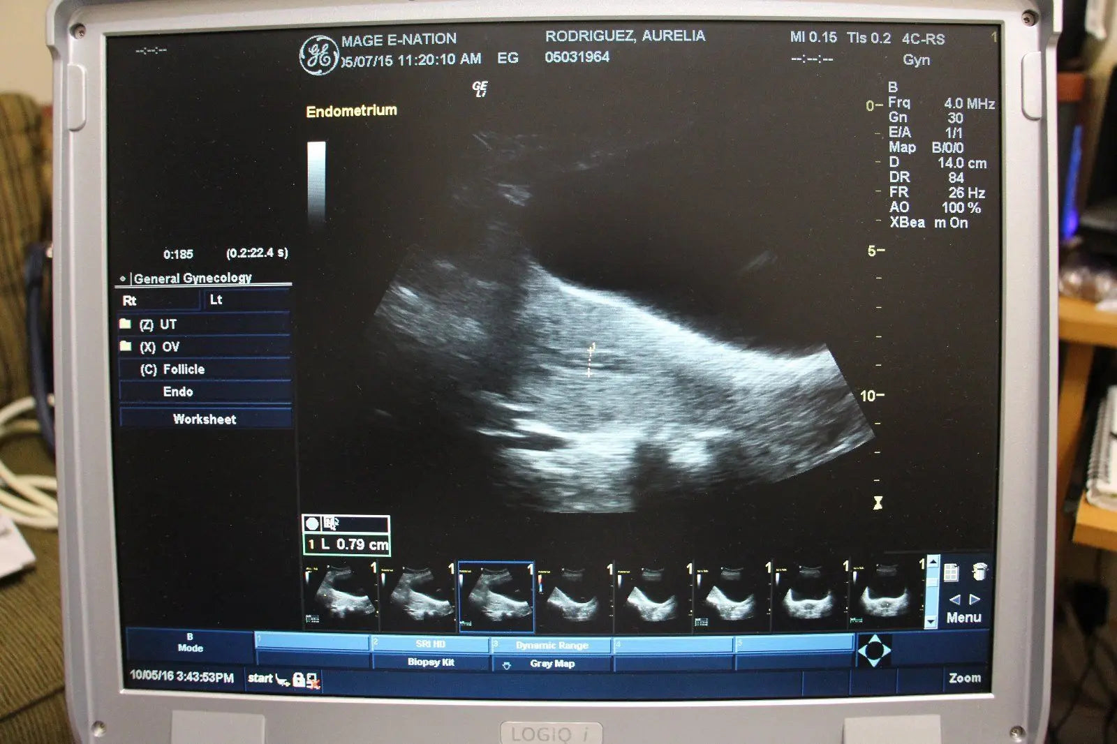 Portable Ultrasound Machine GE LOGIQ i 2007 with 2 Transducers DIAGNOSTIC ULTRASOUND MACHINES FOR SALE