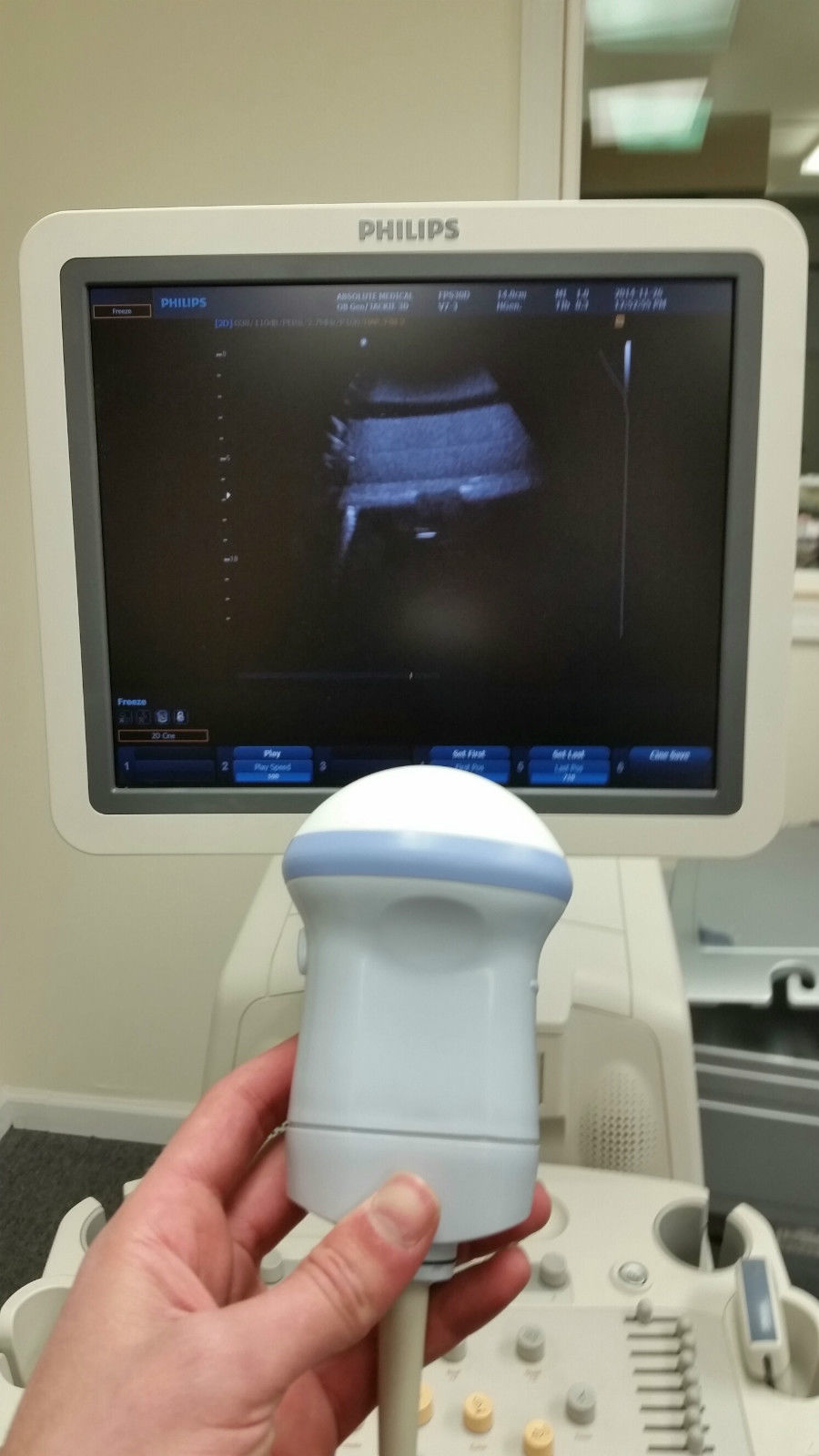 Philips HD9 Ultrasound System - Ob/GYN - with V7-3, V9-4v & C5-2