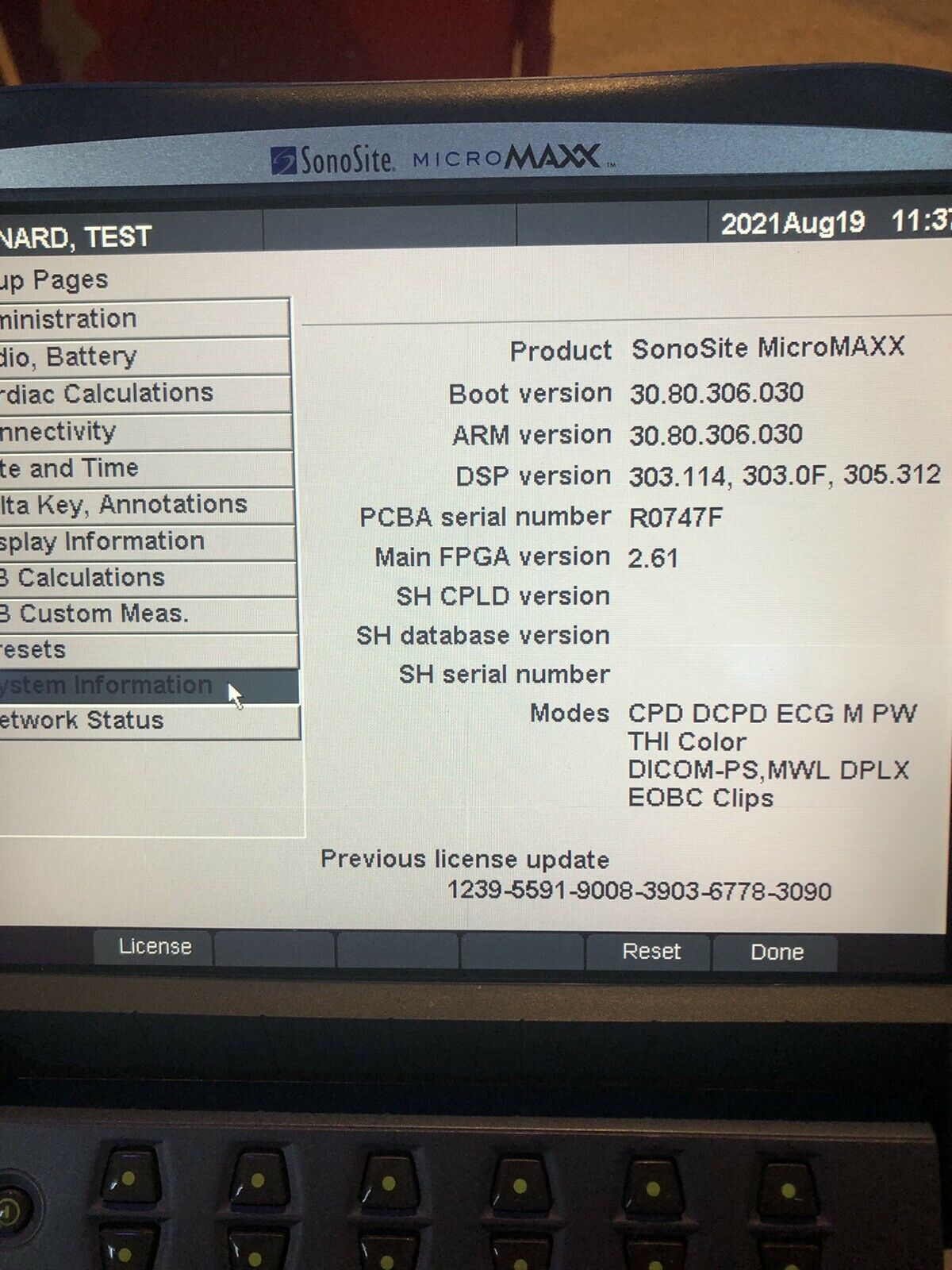 SONOSITE MICROMAXX 2007 Portable Ultrasound With C60E Transducer Probe . Refurbi DIAGNOSTIC ULTRASOUND MACHINES FOR SALE