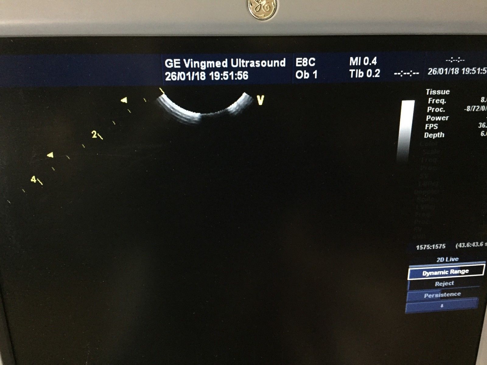 GE E8C Probe Ultrasound Transducer DIAGNOSTIC ULTRASOUND MACHINES FOR SALE