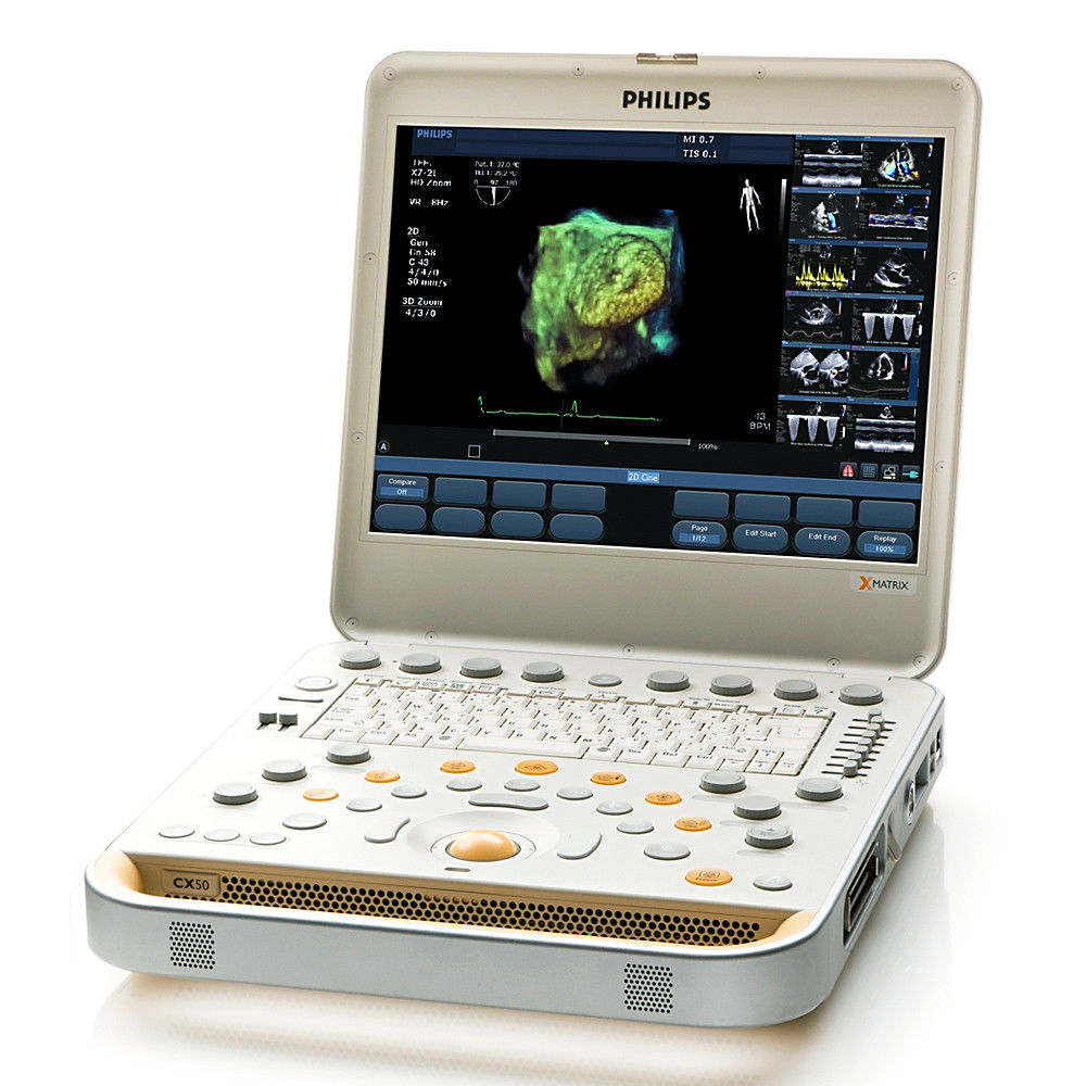 Philips CX50 Portable Ultrasound System with S5-1 Cardiac Sector Transducer DIAGNOSTIC ULTRASOUND MACHINES FOR SALE