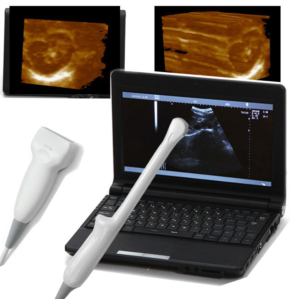 Linear+Transvaginal Probe Portable Laptop Ultrasound Scanner+Free 3D Software CE 190891829528 DIAGNOSTIC ULTRASOUND MACHINES FOR SALE