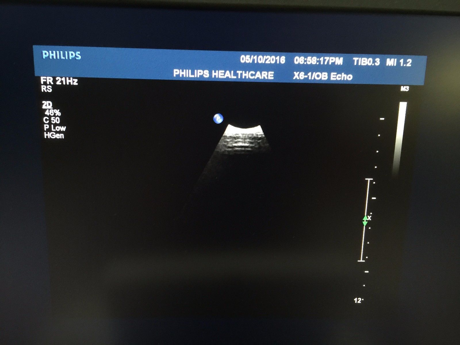 ultrasound monitor 