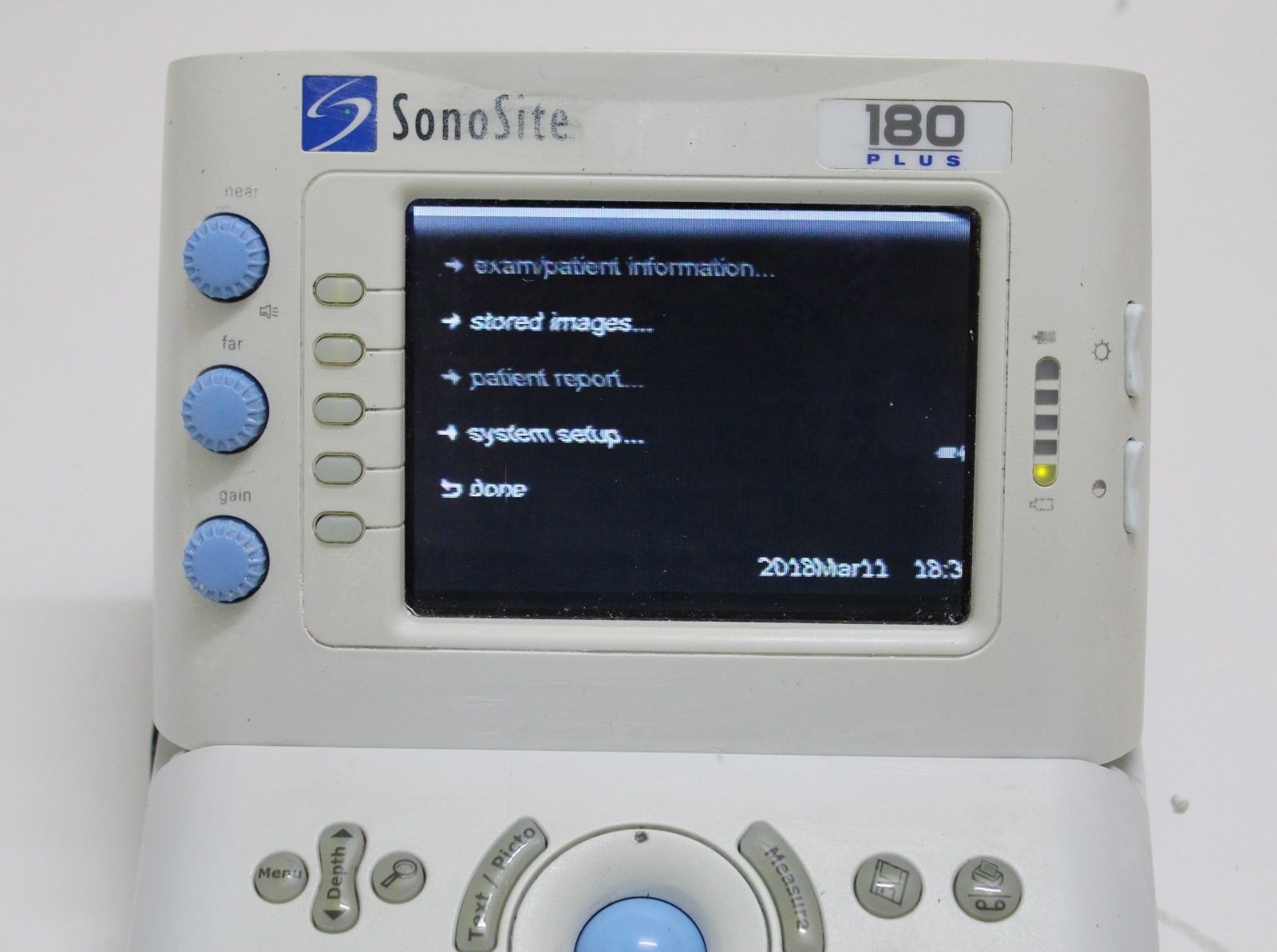 Sonosite 180 Plus Ultrasound (please read) DIAGNOSTIC ULTRASOUND MACHINES FOR SALE