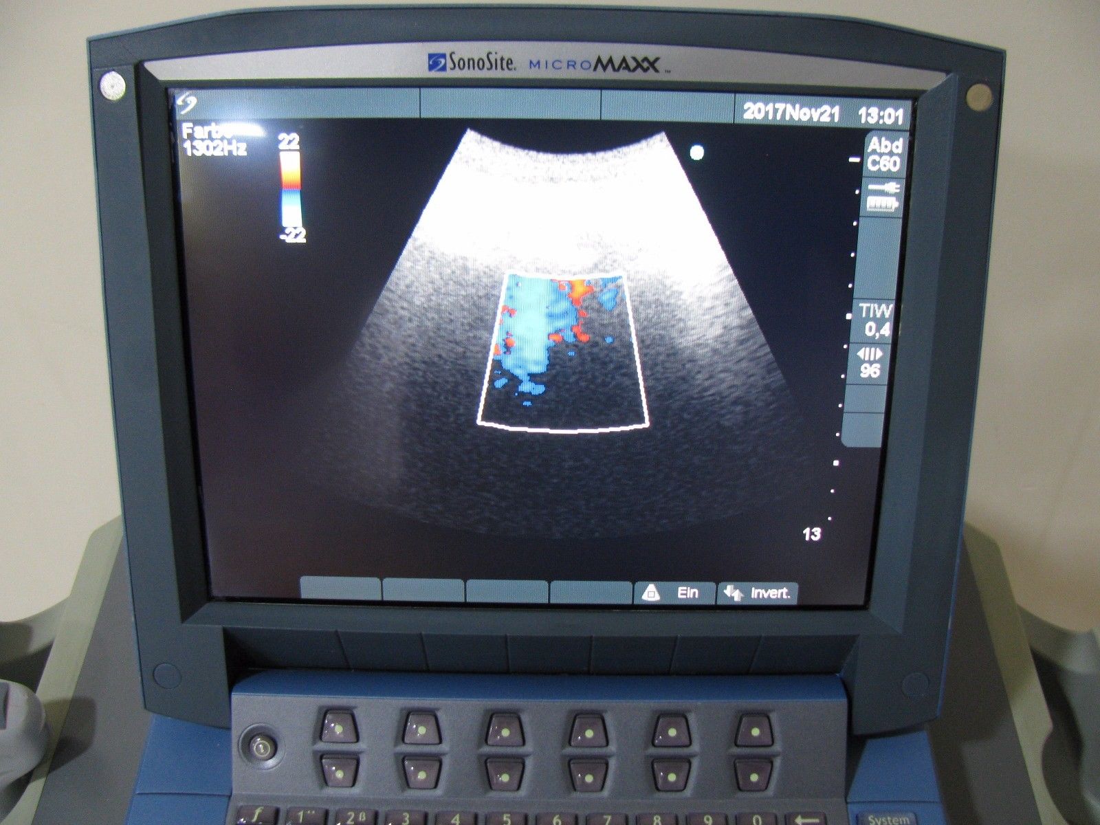 Ultrasound machine Sonosite Micromaxx with cart and three probes DIAGNOSTIC ULTRASOUND MACHINES FOR SALE
