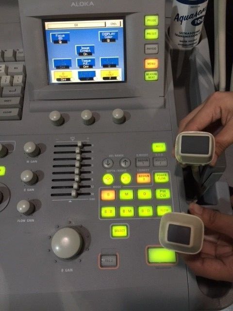 Aloka SSD 5500 Ultrasound Machine DIAGNOSTIC ULTRASOUND MACHINES FOR SALE