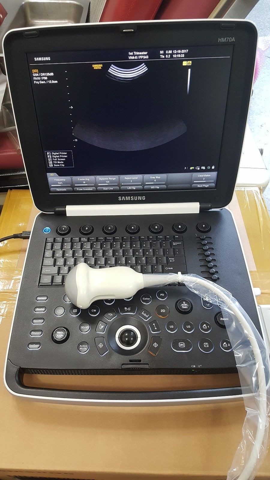SAMSUNG MEDISON UGEO HM70A - THREE PROBES - DIAGNOSTIC ULTRASOUND MACHINES FOR SALE