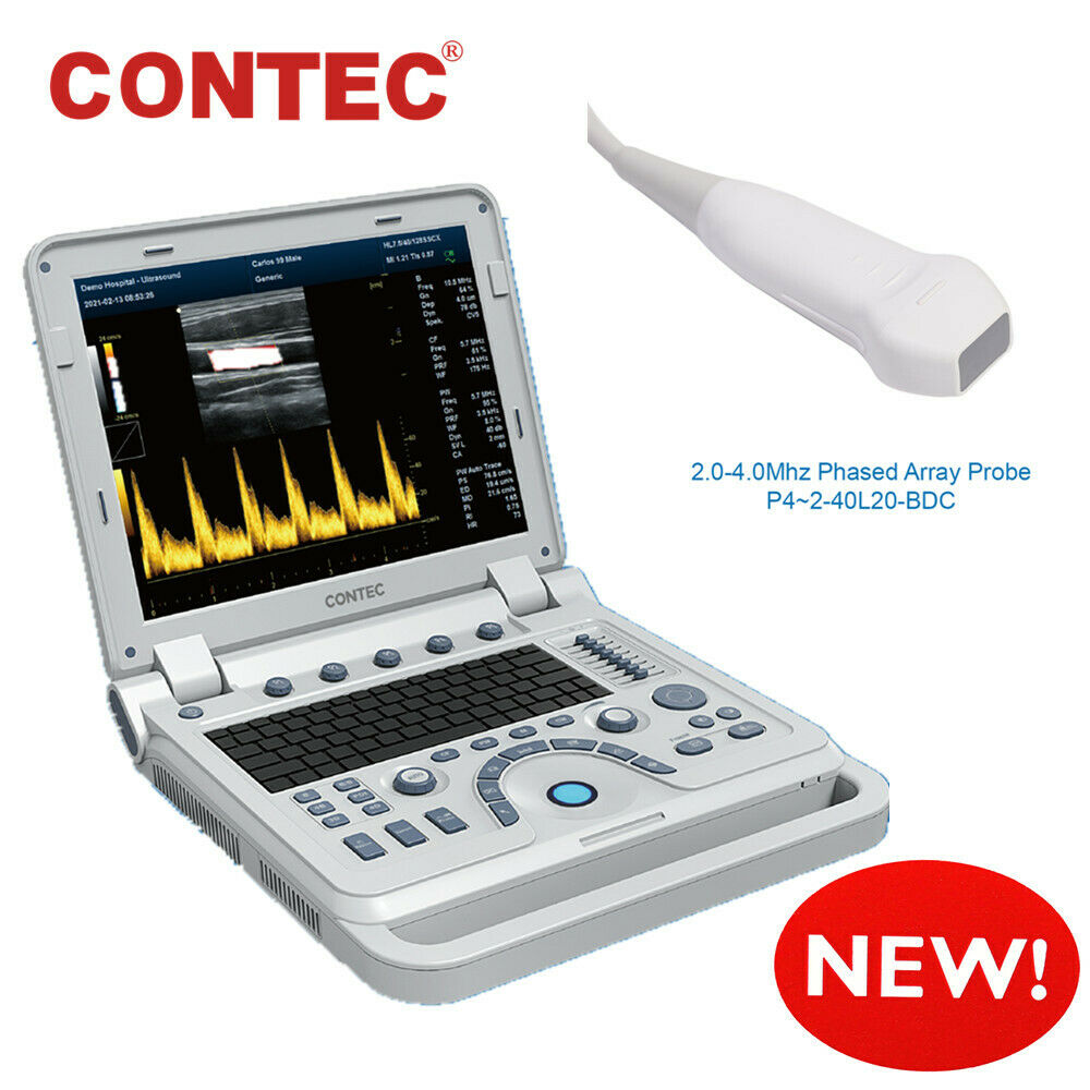 Cardioscan Machine Portable Cardiac Ultrasound Scanner Diagnostic Color Doppler Phased