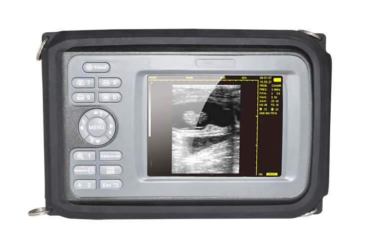 Handheld LCD Digital SystemUltrasound Scanner + 6.5MHz Transvaginal Probe 64Case 190891411099 DIAGNOSTIC ULTRASOUND MACHINES FOR SALE